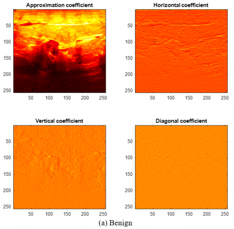 Hybrid Feature Selection Using the Firefly Algorithm for Automatic ...