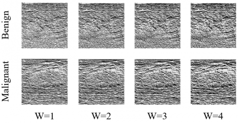 Hybrid Feature Selection Using the Firefly Algorithm for Automatic ...