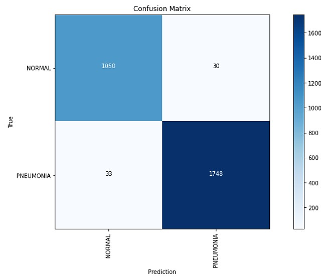 Efficient Deep Learning Approach for the Classification of Pneumonia in ...