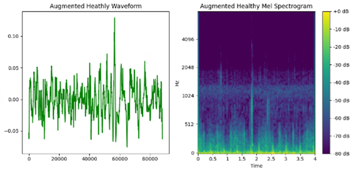 Harmonizing Respiratory Sound Insights: Unleashing the Potential of ...